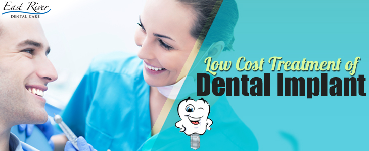 Tips On Finding Low Cost Dental Implants Treatment - East River Dental Care - Newmarket - Ontario - Canada
