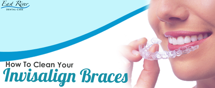 How To Clean Invisalign Braces - Invisalign Newmarket - East River Dental Care - Dentist Newmarket