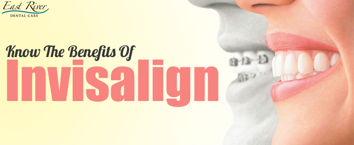 Know The Benefits Of Invisalign Treatment