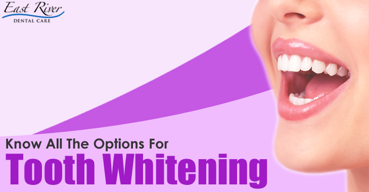 Know All The Options For Teeth Whitening - Tooth Whitening Treatment Newmarket - East River Dental Care