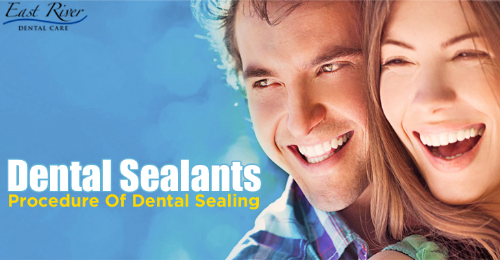 Dental Sealants and Procedure of Dental Sealing