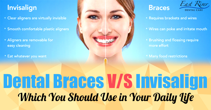 Invisalign Or Braces - Newmarket Dentist - East River Dental Care