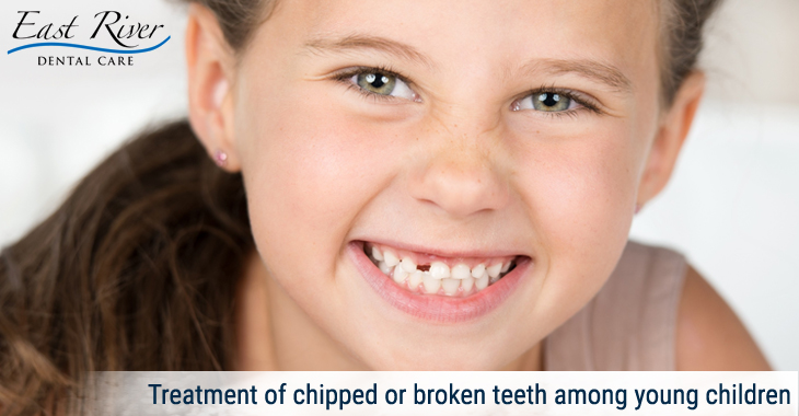 Treatment of chipped or broken teeth among young children