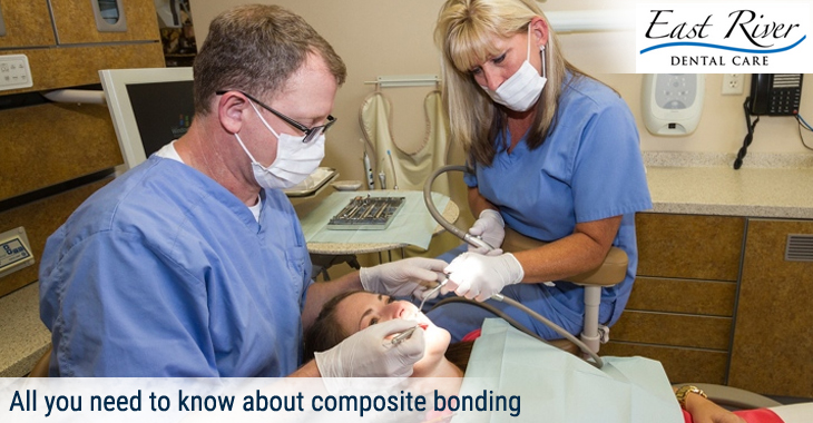 All you need to know about composite bonding