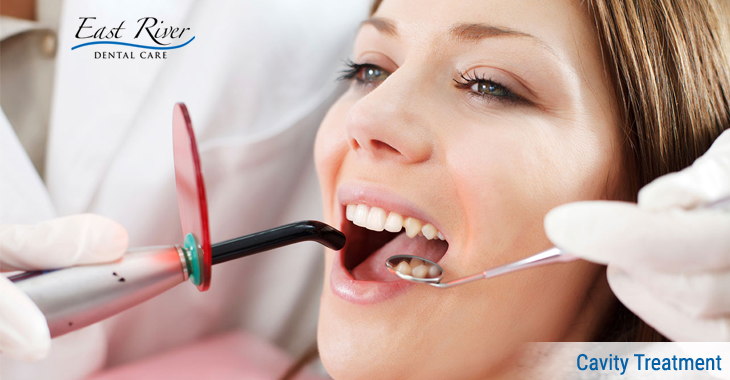 Cavity Treatment in Newmarket
