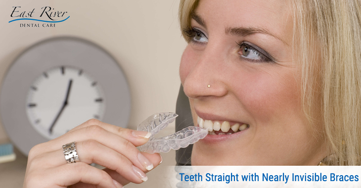 Make your Teeth Straight with Nearly Invisible Braces