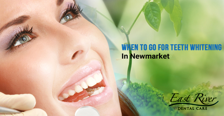 When To Go For Teeth Whitening In Newmarket