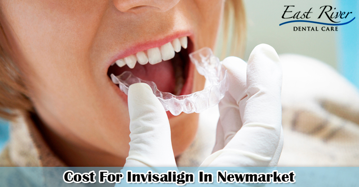 Cost For Invisalign In Newmarket – Dentist Newmarket