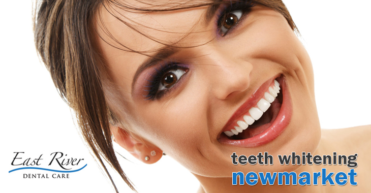 Teeth Whitening at a Clinic: Is It For You?