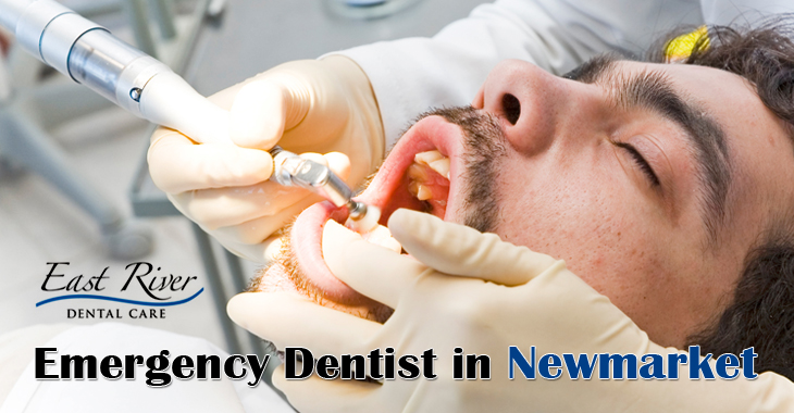 When to Call An Emergency Dentist