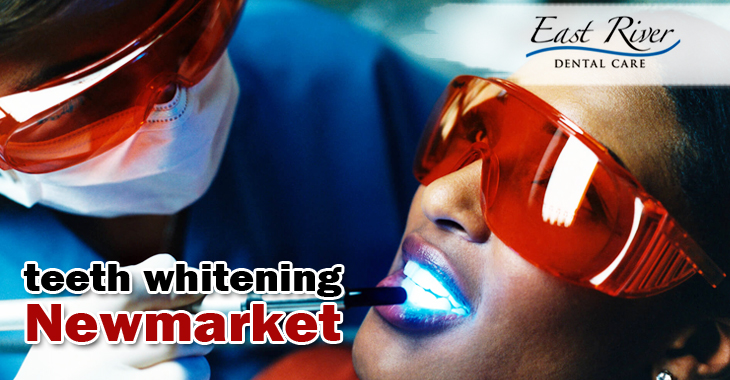 Is Laser Teeth Whitening Safe?