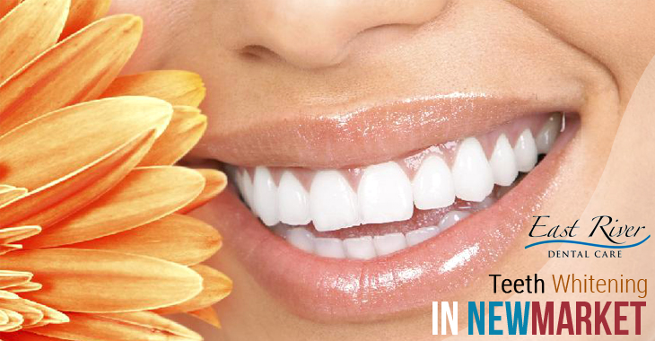 Is Visiting a Teeth Whitening Clinic Worth My Time?