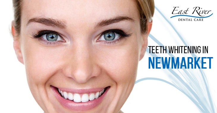 Teeth Whitening Clinic Newmarket